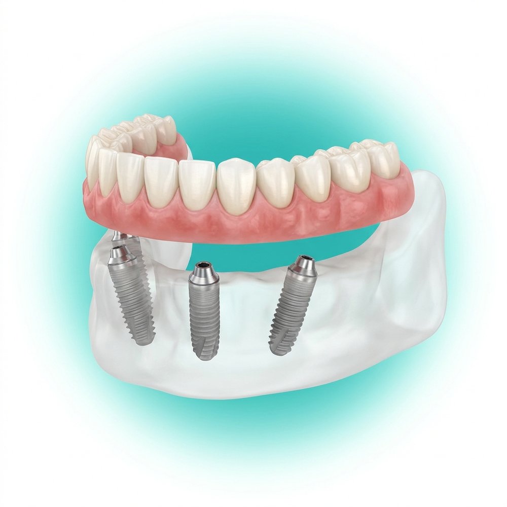 All-on-4 em Tramandaí — Oral Unic Tramandaí